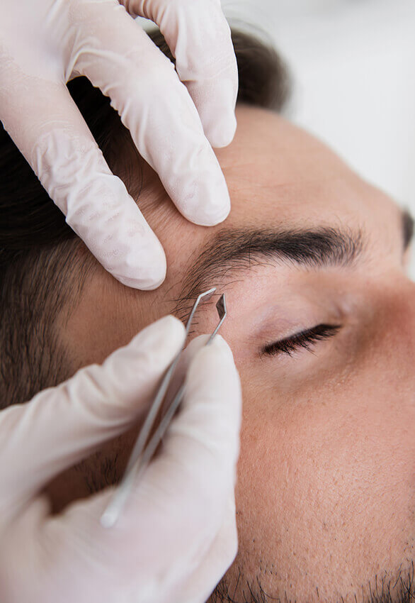 epilation-homme